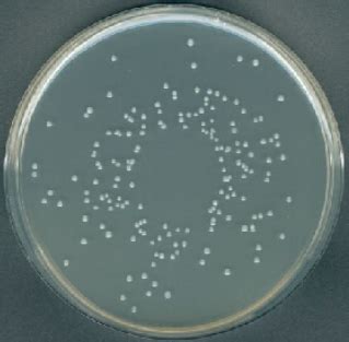 Turn the plate at least 5 times as you move the glass spreader to distribute the bacteria over the plate. PLATE COUNT AGAR - INDUSTRIA NACIONAL DE MICROBIOLOGIA SAS