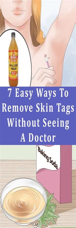 7 easy ways to remove skin tags without seeing a doctor ⋆ china life and buying guide