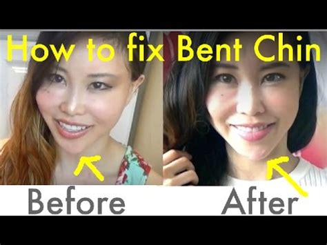 To have a chiseled jawline. Spoon Exercise for Bent Chin/Jawline | How to Fix ...