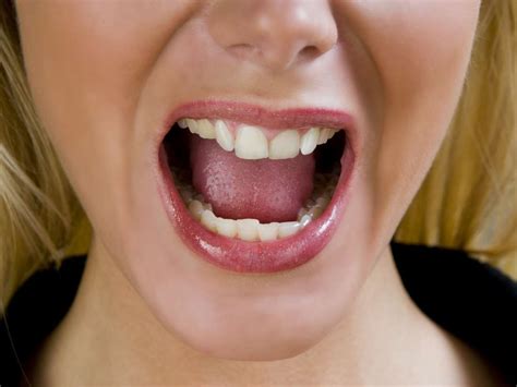 Burning tongue (burning mouth syndrome): Causes and home remedies