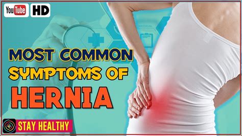 10 Symptoms Of Sports Hernia Facty Health 429