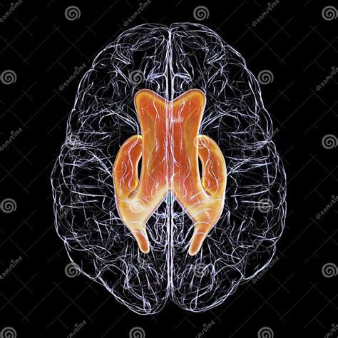 Enlarged Lateral Ventricles Of The Brain 3d Illustration Stock