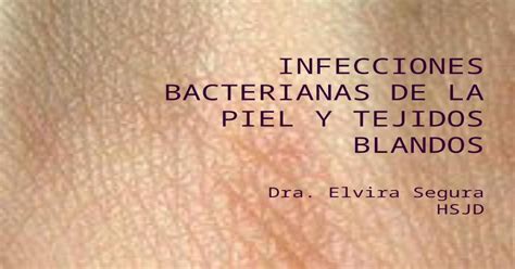 Infecciones Bacterianas De La Piel Y Tejidos Blandos Dra Elvira Segura