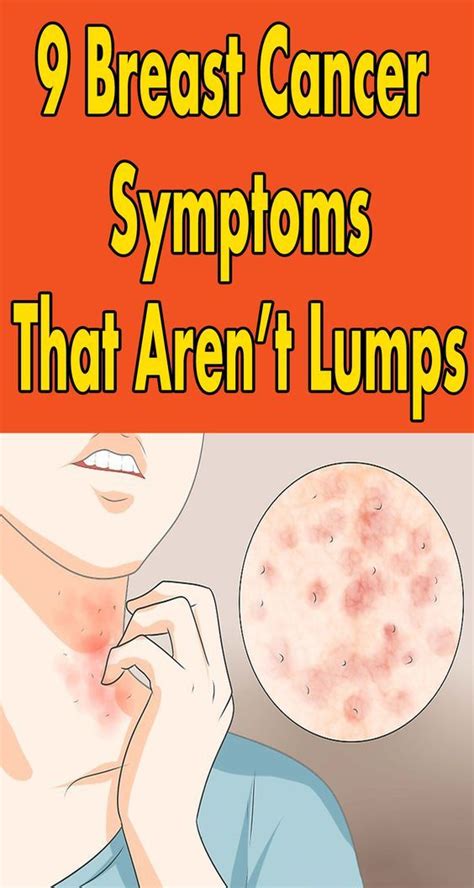 9 Breast Cancer Symptoms That Arent Lumps Sweet Oh Joy