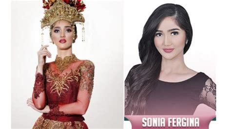 Sonia Fergina Citra Putri Indonesia Kedua Asal Babel Setelah Artika