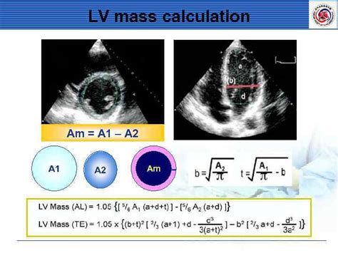 Standard Imaging Of Transthoracic Echocardiography Terminology A