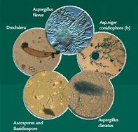 Image result for mold pictures