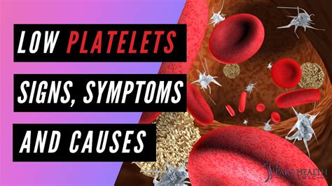Low Platelets Signs And Symptoms Youtube