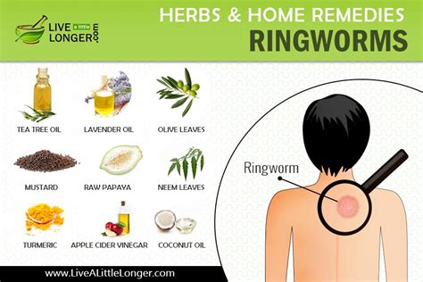 10 Incredible Home Remedies For Ringworms