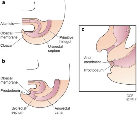 1 Embryology Of The Anorectum A The Cloaca—the Fusion
