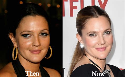 Drew Barrymore Plastic Surgery Before And After Photos Latest Plastic