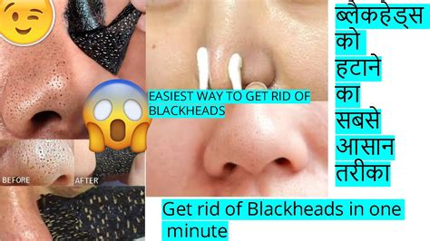 ब्लैकहेड्स को हटाने का सबसेआसान तरीका easy diy blackheads removal peel off mask at home youtube