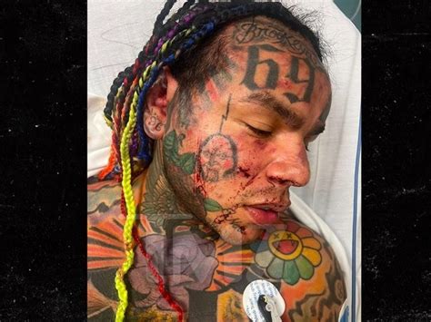 Rapper 6ix9ine Hospitalized After Reportedly Being Attacked By Multiple