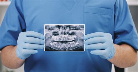 ¿cuál Es La Utilidad De Una Radiografía Dental Imed Dental