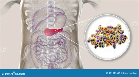 Human Pancreas And Close Up View Of Insulin Molecule Stock Illustration