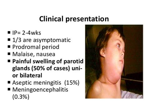 Salivary Gland Infections