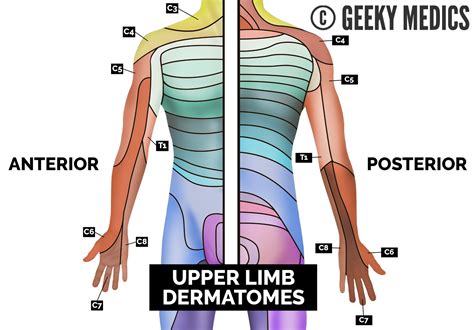 Dermatomes Upper Limb