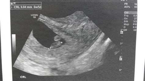 Hi, i've got my dating scan on july 14th. dating scan :) - February 2016 - BabyCenter Australia