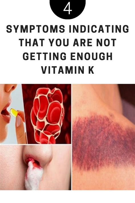 Vitamin k supplement benefits for skin. 4 symptoms indicating that you are not getting enough ...