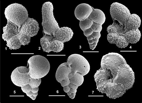 Foraminafera Under An Electron Microscope Sex Drugs And Sea Slime