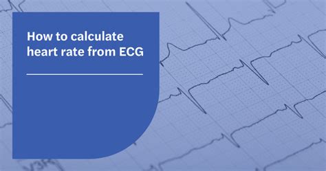 How To Calculate Heart Rate From Ecg Seer Medical Uk