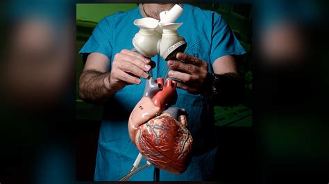 1000th Heart Transplant Performed At Houston Methodist Hospital