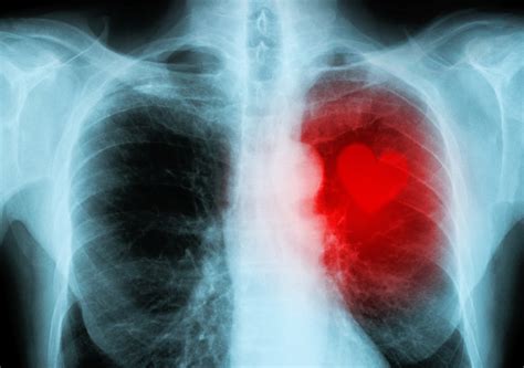 When you have heartburn, some of the. What Causes Heartburn in Women? | STD.GOV Blog