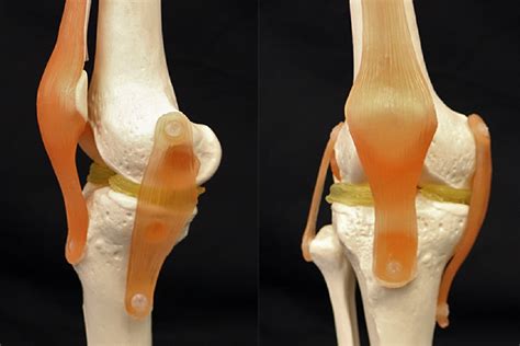 Cartilage cells can be cloned and reproduced in a lab. 3D printing could help repair damaged knees with cartilage ...
