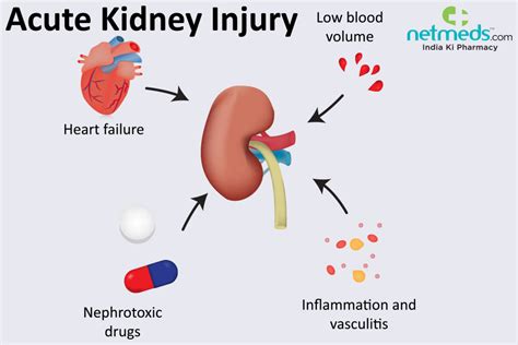 Acute Kidney Failure Causes Symptoms And Treatment