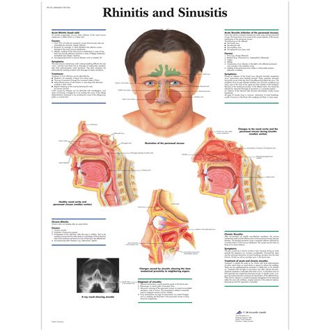 Ear Nose Throat Anatomy Chart Poster Laminated Ubicaciondepersonas Cdmx Gob Mx