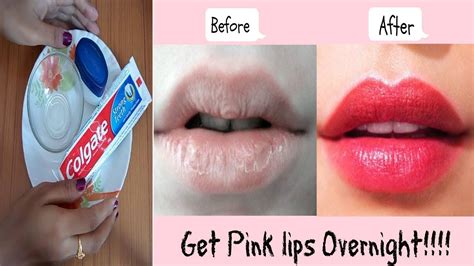 But, how to get pink lips naturally? How to get pink lips permanently in overnight - Turn your ...