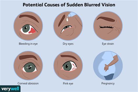 What Can Cause Blurred Vision All Of A Sudden Infrared For Health