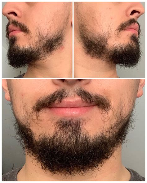 How To Grow Facial Hair In A Week Beard On Brother