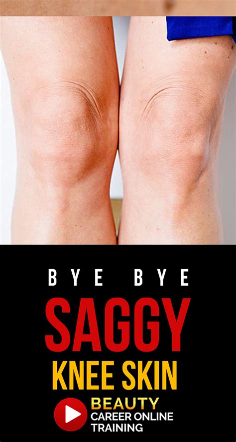 Diy Home Remedy For Lifting And Tightening Saggy Knee Leg Skin Beauty