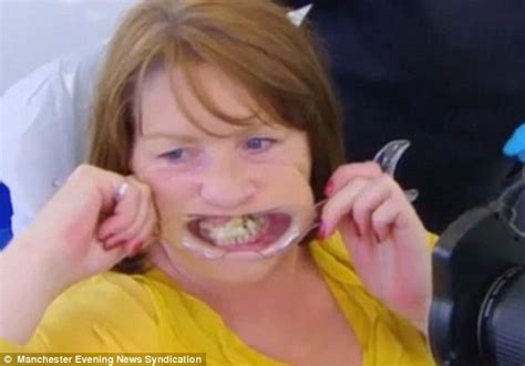 Mother Terrified Of Dentists Used Superglue To Stick Her Teeth Back In