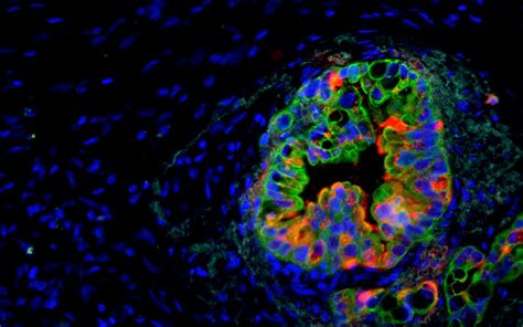 Novel Imaging Model Helps Reveal New Therapeutic Target For Pancreatic