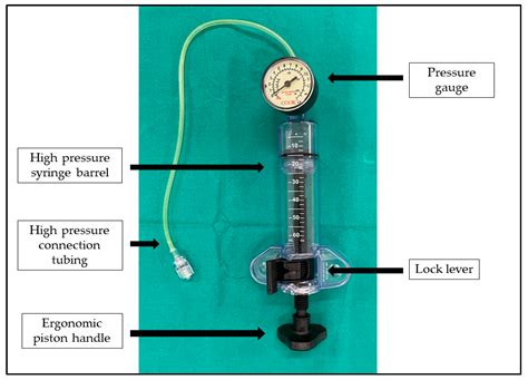 Ijerph Free Full Text Use Of Irrigation Device For Duct Dilatation