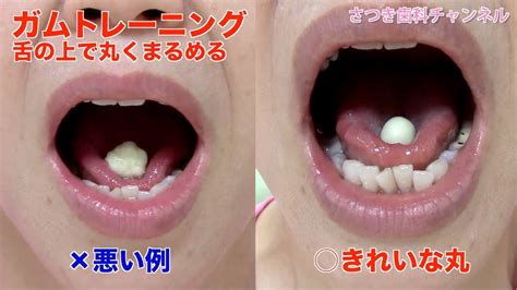 【青森 十和田市 歯医者】ガムトレーニングで噛む力＆舌の動きアップ！ さつき歯科チャンネル022（口腔ケアチャンネル） Youtube