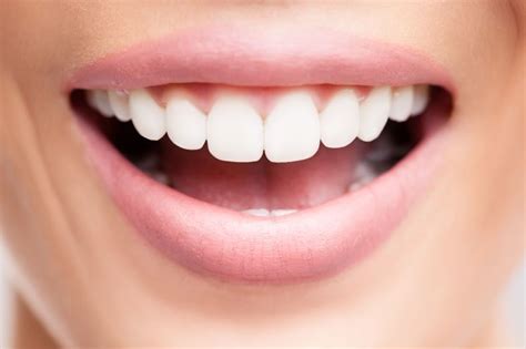 What are dental veneers and how much do they cost? Laminate Teeth Veneers - How Much Do They Cost? | Novacorpus