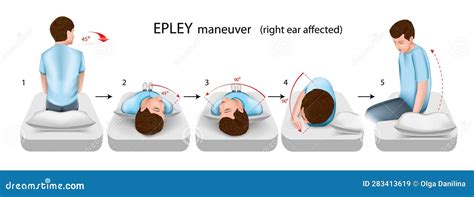 Epley Maneuver Right Ear Affected Vector Illustration Cartoondealer