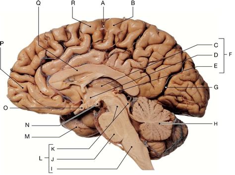 Mid Sagittal Section Of The Human Brain Diagram Quizlet