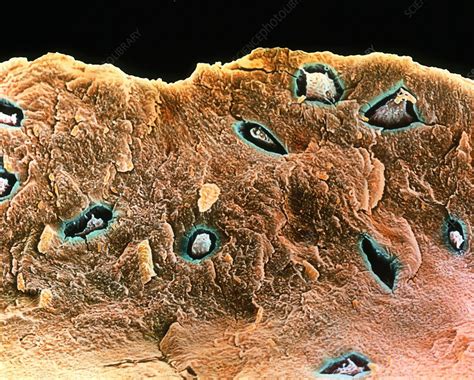 Sem Of Osteoblast Cells In A Bone Matrix Stock Image P1050115