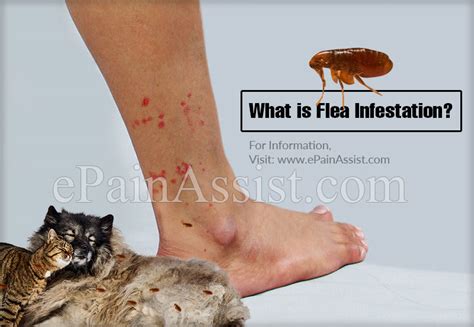 How To Tell If You Have Fleas In Your House Information Wow