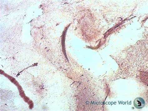 Check spelling or type a new query. Microscope World Blog: Chromosomes under the Microscope