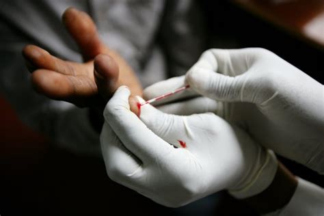 هل تحليل الدم الشامل يكشف الايدز