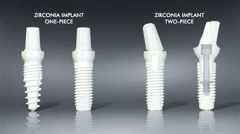 Why Is Zirconia A Perfect Material For Dental Implants Dental