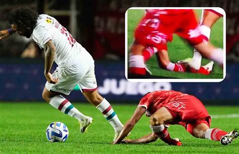 Footballer Breaks Leg బంతిని త‌న్న‌బోయి ప్ర‌త్య‌ర్థి కాలు విర‌గొట్టిన ఫుట్‌బాల‌ర్ ఆపై ఏం జ