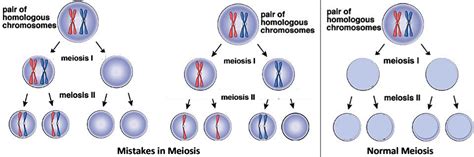 How Mistakes In Meiosis Can Result In Down Syndrome Or Death Of An