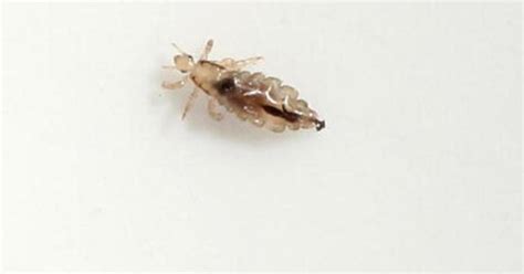 Study Super Lice Now Exist In 48 States
