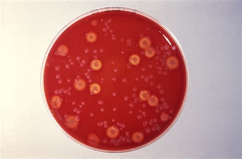 Free Picture Blood Agar Culture Plate Grew Representative
